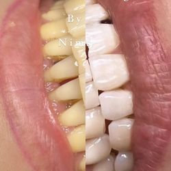 Sugar Esthetics By Nims
