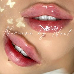 Medspa Nirvana by Noel - Actual Client Photo