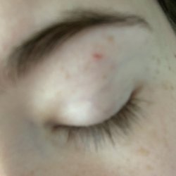 Brow Threading - Cut left eyebrow from threading