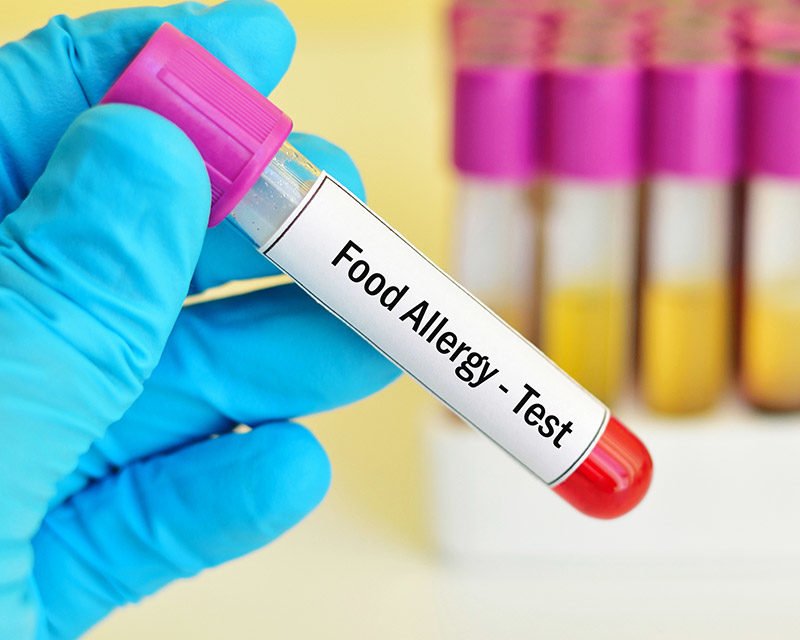 ACCU REFERENCE MEDICAL LAB BAYONNE 546 Ave C, Bayonne, New Jersey