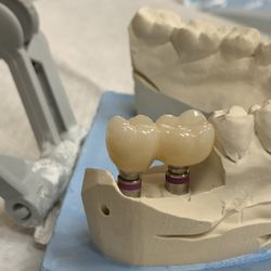 Contemporary Periodontics & Dental Implants
