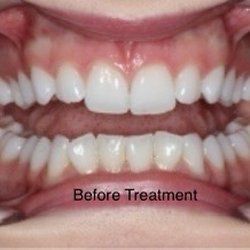 Kirkland - Redmond Orthodontics