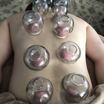 Mountain Monarch Herbals - Glass Cupping Therapy - Massage Therapy Near Me Mountain Monarch Herbals - Glass Cupping Therapy - Massage Therapy Near Me