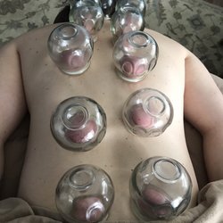Mountain Monarch Massage & Herbals - Glass Cupping Therapy