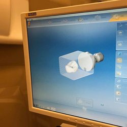 Barry G Kami, DDS - 3. A three dimensional image of the original tooth is taken. The image is sent to the machine that manufactures the crown to proper size.
