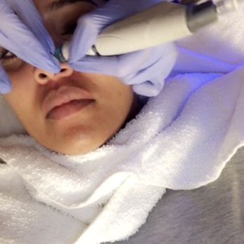 Cupertino Facial Esthetics - Cosmetic Dentists Near Me - Cupertino, California Cupertino Facial Esthetics - Cosmetic Dentists Near Me - Cupertino, California