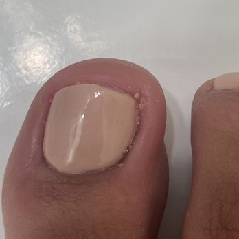 Vida Nail Spa - My toe after the pedicure. - Nail Salons Near Me - Oakley, California