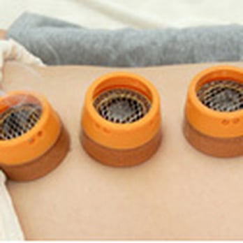Root Acupuncture Clinic - Moxibustion ( Heat Therapy ) - Acupuncture Near Me - Thousand Oaks, California Root Acupuncture Clinic - Moxibustion ( Heat Therapy ) - Acupuncture Near Me - Thousand Oaks, California