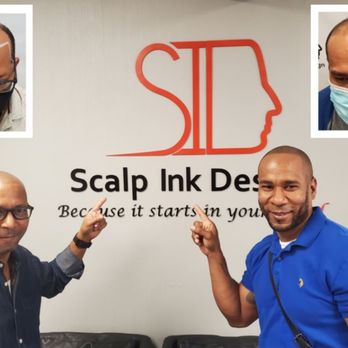 Scalp Ink Design - Hair Loss Centers Near Me - Miami, Florida Scalp Ink Design - Hair Loss Centers Near Me - Miami, Florida