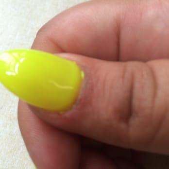 Tip2toe Nail Spa and Lashes - Look at my poor thumb - Nail Salons Near Me - Norwalk, California Tip2toe Nail Spa and Lashes - Look at my poor thumb - Nail Salons Near Me - Norwalk, California