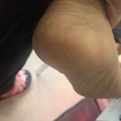 Queens Nail