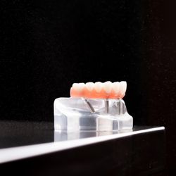 Advanced Dental Implants & Oral Surgery - Bonney Lake