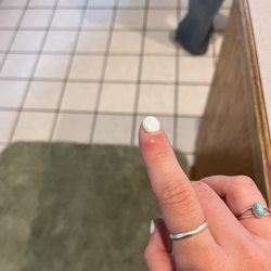 Pristine Nail Salon - Infected finger