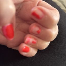 This was not picking at nails, just started coming off.