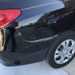Springfield Hyundai - Four year old dent in 2009 Elantra.
