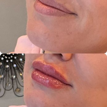 Blush Aesthetic Bar - Aestheticians Near Me - Overland Park, Kansas Blush Aesthetic Bar - Aestheticians Near Me - Overland Park, Kansas