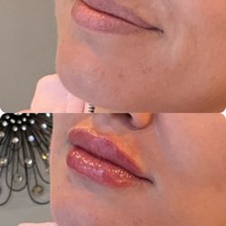 Blush Aesthetic Bar