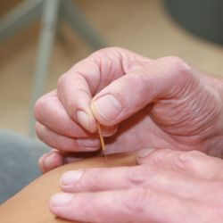 Fysiotherapie Van Ham - Dry Needling