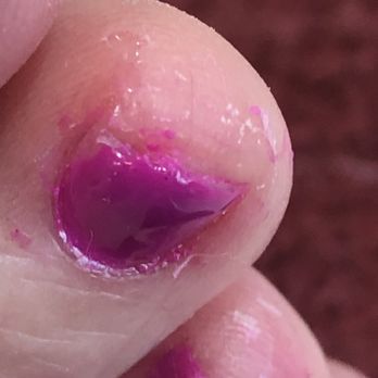 7 Day Spa & Nails - This is one of my toes after the first technician was 'done!' ‍ - Nail Salons Near Me - Tempe, Arizona