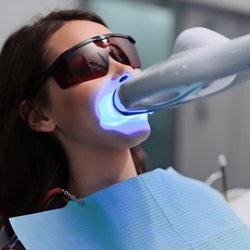We Whiten LA - We whiten La , Laser whitening service