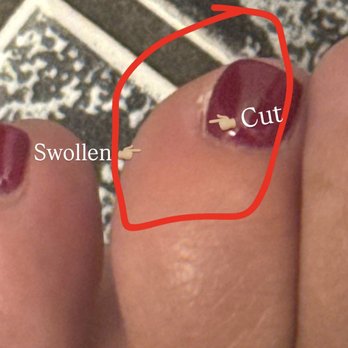 Glow Nails USA - Injured toe - Nail Salons Near Me - Glendale, California Glow Nails USA - Injured toe - Nail Salons Near Me - Glendale, California