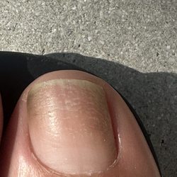 C Nails - Their pedicure gave me an infection