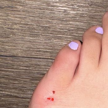 Mimi's Nail Spa - Cut on my foot - Nail Salons Near Me - Northridge, California Mimi's Nail Spa - Cut on my foot - Nail Salons Near Me - Northridge, California