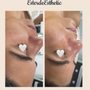 Photo of Ester De Esthetic