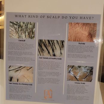 Aroma HeadSpa - Root causes and reasons to come - Skin Care Near Me - Costa Mesa, California Aroma HeadSpa - Root causes and reasons to come - Skin Care Near Me - Costa Mesa, California