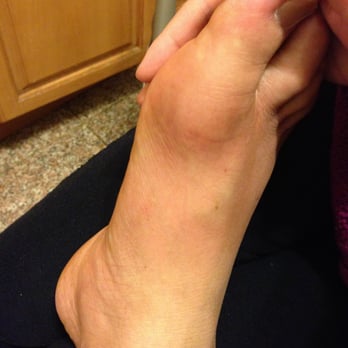 Dzogchen Healing Center - After treatment! (After first visit with Dr. Zhu, my father's leg is much better! My father was suffering from Gout! Thanks Dr. - Acupuncture Near Me - Saratoga, California Dzogchen Healing Center - After treatment! (After first visit with Dr. Zhu, my father's leg is much better! My father was suffering from Gout! Thanks Dr. - Acupuncture Near Me - Saratoga, California