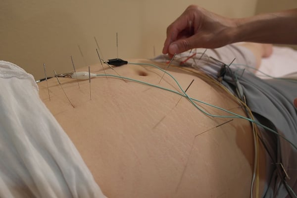 centros de acupuntura para adelgazar en valencia centros de acupuntura para adelgazar en valencia