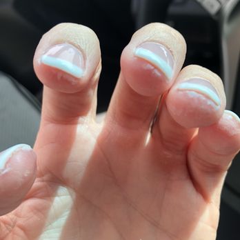 VIP Nail Spa - All the SNS powder was stuck to my skin and would not come off!! - Nail Salons Near Me - Thousand Oaks, California VIP Nail Spa - All the SNS powder was stuck to my skin and would not come off!! - Nail Salons Near Me - Thousand Oaks, California