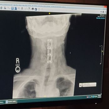 Texas Spine Associates - Spine Surgeons Near Me - Irving, Texas