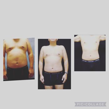 Signature Plastic Surgery - Start-after 30 days and then after 60 day - Medical Spas Near Me - Las Vegas, Nevada