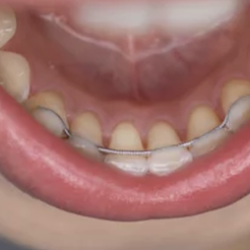 Emergency Dental of Dayton
