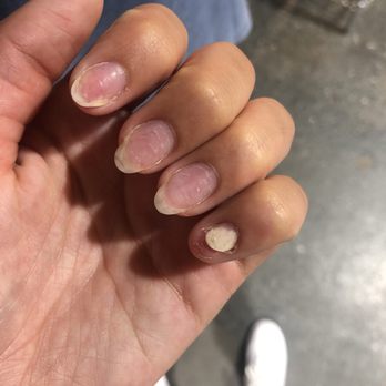 Colorvat Nail Studio - after my visit (they saved a lot, the white is from the part that was lifted but I'm surprised the whole nail didn't come off) - Nail Salons Near Me - New York, New York