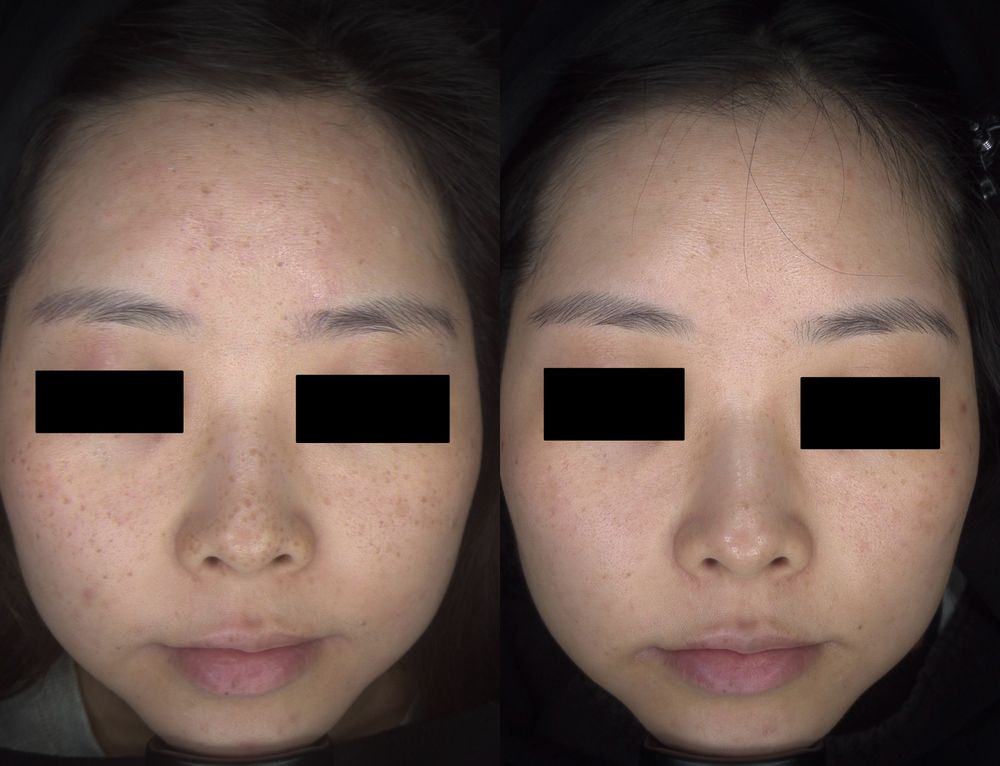 Eye Candy Vision and Beauty Clinic Logo