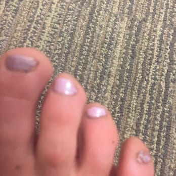 Prive Nail Spa - Feet with old polish still on and hand polish chip after one day. - Nail Salons Near Me - Woodmere, Ohio Prive Nail Spa - Feet with old polish still on and hand polish chip after one day. - Nail Salons Near Me - Woodmere, Ohio
