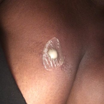 Skin Physicians & Surgeons - More infection - Dermatologists Near Me - Upland, California