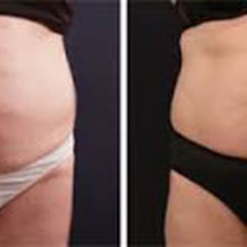 Z Medi Spa - Vanquish - Medical Spas Near Me - Spring, Texas Z Medi Spa - Vanquish - Medical Spas Near Me - Spring, Texas