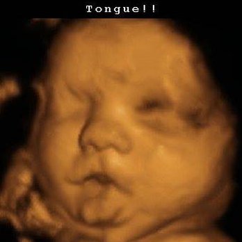 Tiny Toes Prenatal Imaging - Ultrasound Imaging Centers Near Me - Greensboro, North Carolina