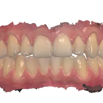 Chris Igawa, DDS - Digital Impressions! - General Dentistry Near Me - Hilo, Hawaii Chris Igawa, DDS - Digital Impressions! - General Dentistry Near Me - Hilo, Hawaii