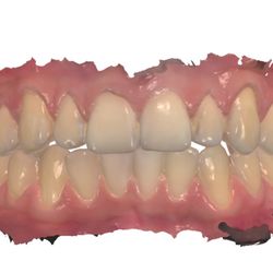 Chris Igawa, DDS - Digital Impressions!