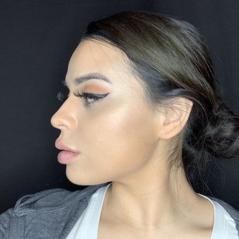 Bex Laser Aesthetix - Rebecca has done the following services on me: Jaw filler, cheek filler, lip filler and Botox! - Laser Hair Removal Near Me - Arlington, Texas