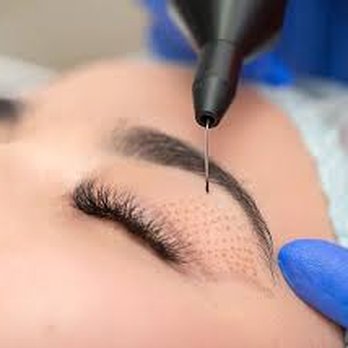 Spa Beleza - PlasmaLift Skin Tightening - Skin Care Near Me - Ketchum, Idaho Spa Beleza - PlasmaLift Skin Tightening - Skin Care Near Me - Ketchum, Idaho