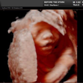 Before the Stork 4D - Ultrasound Imaging Centers Near Me - Anaheim, California Before the Stork 4D - Ultrasound Imaging Centers Near Me - Anaheim, California