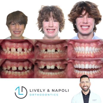Napoli Orthodontics - Orthodontists Near Me - Stuart, Florida Napoli Orthodontics - Orthodontists Near Me - Stuart, Florida