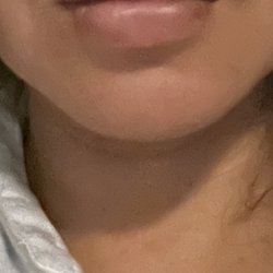 Synerchi Medical Spa - The pouty without the duck look.  Love it!