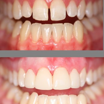 Ridge Park Dental - General Dentistry Near Me - Layton, Utah Ridge Park Dental - General Dentistry Near Me - Layton, Utah