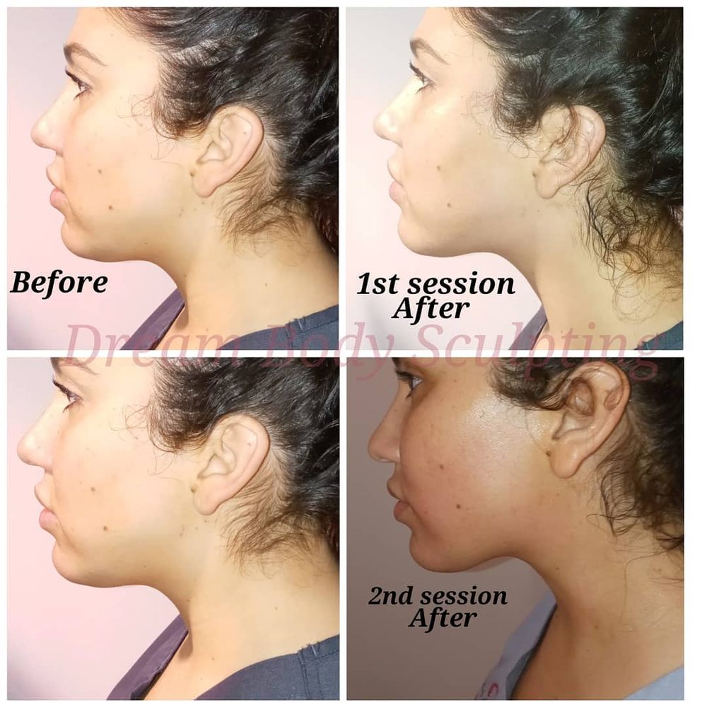 DREAM BODY SCULPTING Updated August 2024 10 Photos 1333 3rd Ave